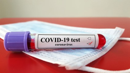 Covid-19-Blutprobe